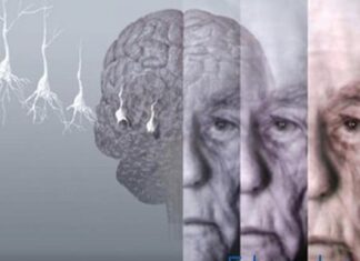 El nuevo fármaco contra alzheimer, «esperanzador» en diagnósticos tempranos