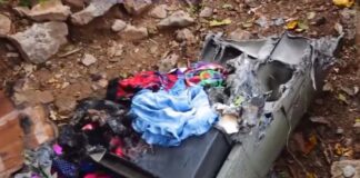 ¡Por una candela! Dos niñas resultan gravemente heridas tras incendio en Comayagua