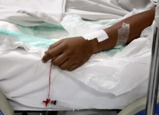 Fallece segundo paciente con sospecha de «hongo negro» en Honduras