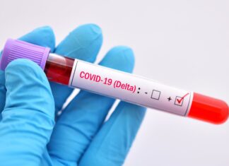 Doctor confirma el tercer caso de variante Delta a través de pruebas en laboratorio privado