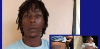 Un hombre le roció ácido de batería en el cuerpo a su expareja, ocasionándole graves quemaduras, en la zona norte del país