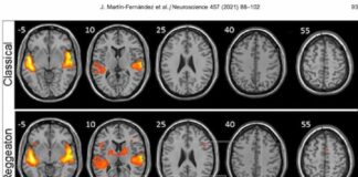 Investigadores dicen que el reguetón provoca mayor actividad cerebral que escuchar música clásica o folclore