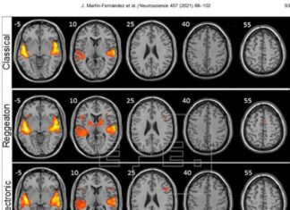 Investigadores dicen que el reguetón provoca mayor actividad cerebral que escuchar música clásica o folclore