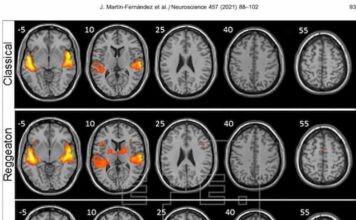 Investigadores dicen que el reguetón provoca mayor actividad cerebral que escuchar música clásica o folclore