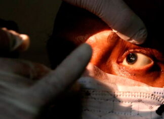 Hongo negro, otra enfermedad que crece aceleradamente en Honduras