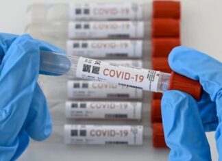 Investigan laboratorios no autorizados para practicar pruebas de Covid-19 en Honduras