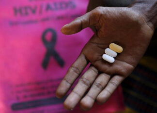 Descubren que las medicinas para el VIH y sida pueden combatir problemas neurológicos