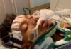 Hondureño queda en coma tras recibir golpiza por desconocido en Phoenix, Arizona