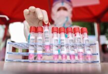 Científicos de Sudáfrica hallan una nueva variante de coronavirus muy mutante