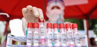 Científicos de Sudáfrica hallan una nueva variante de coronavirus muy mutante