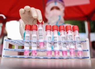 Científicos de Sudáfrica hallan una nueva variante de coronavirus muy mutante