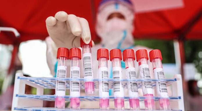 Científicos de Sudáfrica hallan una nueva variante de coronavirus muy mutante