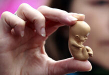 R.Unido confirma legalidad de abortar fetos con síndrome de Down hasta el parto