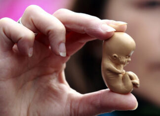 R.Unido confirma legalidad de abortar fetos con síndrome de Down hasta el parto