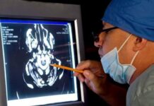 Más de 20 mil hondureños sufren de alzhéimer, revelan neurólogos