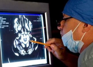 Más de 20 mil hondureños sufren de alzhéimer, revelan neurólogos