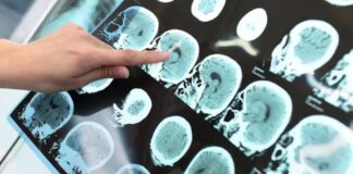 Detectan el primer caso de «síndrome del ano inquieto» como consecuencia del Covid-19