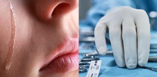 Paciente asegura que en un hospital de Estados Unidos le cobraron 200 dólares por llorar en su cirugía