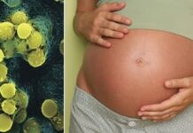 La OMS hace un llamado urgente a crear una vacuna contra una bacteria mortal para miles de bebés