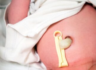 Retrasar el pinzamiento del cordón umbilical salva vidas en los bebés prematuros