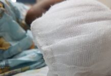 Niño pierde todos los dedos de su mano izquierda tras explotarle un mortero