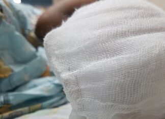 Niño pierde todos los dedos de su mano izquierda tras explotarle un mortero