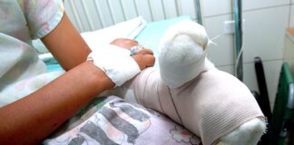 Niña de 11 años pierde una de sus manos tras la explosión de un mortero en Copán