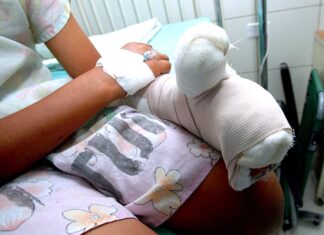 Niña de 11 años pierde una de sus manos tras la explosión de un mortero en Copán