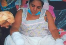 Mujer que fue atacada a machetazos por un hombre en Choluteca, relata que la ha dejado en desgracia