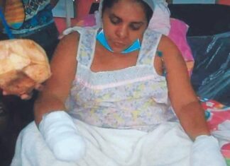 Mujer que fue atacada a machetazos por un hombre en Choluteca, relata que la ha dejado en desgracia