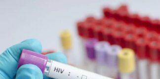 Mujer es curada del VIH tras un trasplante de células madre en EE. UU.