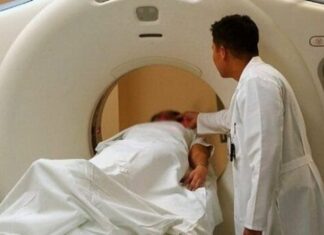 Más de 50 mil personas padecen de epilepsia en Honduras