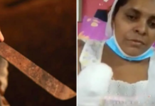 Hombre “enamorado” le corta las manos a una mujer en Choluteca, porque ella no le hizo caso