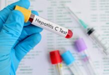 La OMS confirma ya 169 casos de nueva hepatitis aguda infantil en 11 países