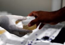 Desarrollan un test de orina para detectar anticuerpos contra el SARS-CoV-2