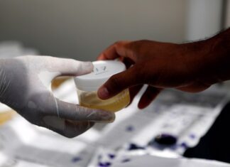 Desarrollan un test de orina para detectar anticuerpos contra el SARS-CoV-2