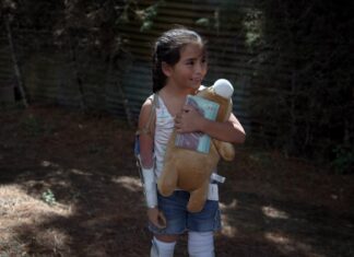 Conozca a Carol, la niña guatemalteca que aprende a abrazar con nuevas extremidades