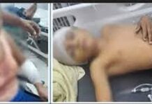 Fallece un niño tras defender a su abuela quien estaba recibiendo una golpiza por su propio hermano