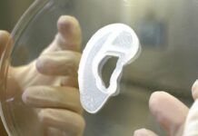Implantan por primera vez una oreja humana creada por células de la paciente gracias a una impresora 3D