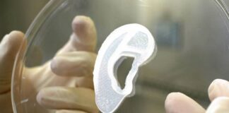 Implantan por primera vez una oreja humana creada por células de la paciente gracias a una impresora 3D