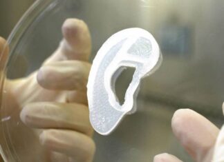 Implantan por primera vez una oreja humana creada por células de la paciente gracias a una impresora 3D