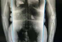 Capturan a una mujer por intentar ingresar droga en sus partes íntimas a la cárcel de Támara