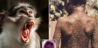 La población menor de 44 años tiene mayor probabilidad para contraer viruela del mono, estima la Sesal