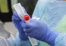 Cinco centros de salud aplican pruebas contra el Covid-19 ante el incremento de contagios en Tegucigalpa