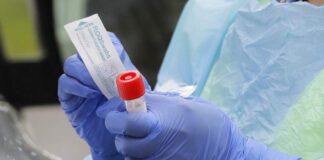 Cinco centros de salud aplican pruebas contra el Covid-19 ante el incremento de contagios en Tegucigalpa