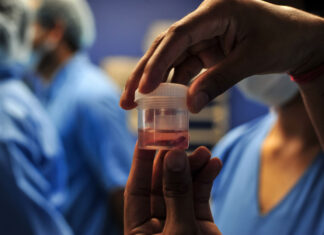 Honduras registra 41 casos de la infección conocida como hongo negro