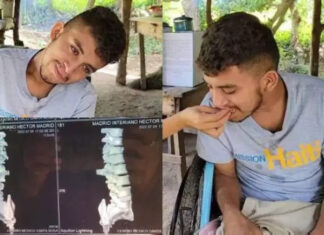 Por no poder pagar una deuda de 800 lempiras dejan paralítico a un joven hondureño en Copán