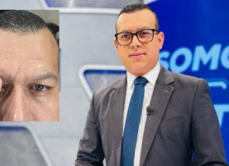 El periodista Alex Cáceres fue agredido por colectivos de Libre cuando daba cobertura a una protesta
