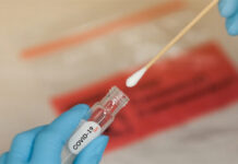 El 41% de pruebas de Covid-19 realizadas en el triaje municipal de SPS en los últimos 8 días dieron positivo