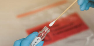 El 41% de pruebas de Covid-19 realizadas en el triaje municipal de SPS en los últimos 8 días dieron positivo